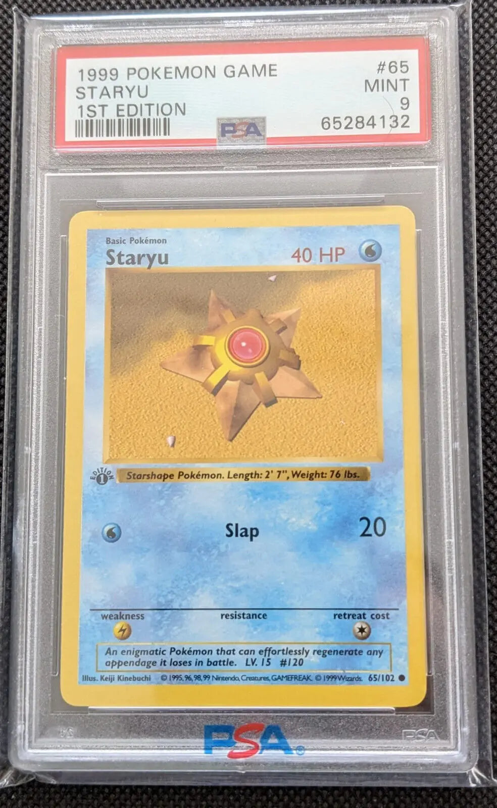 Shadowless! PSA 9 + 1. Edition Sterndu 65/102 Staryu Basis Set Pokemon Karte English - Image #1